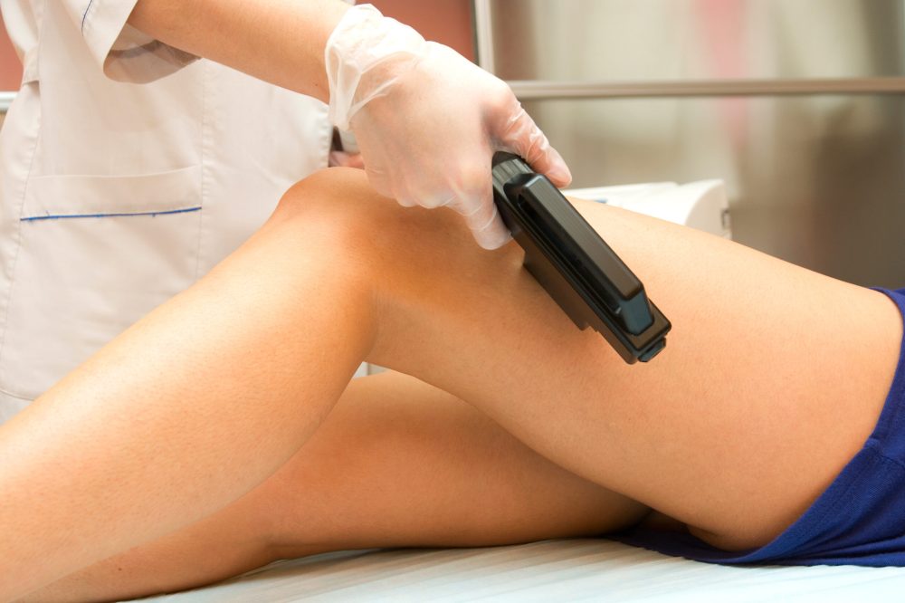 whatislaserhairremoval